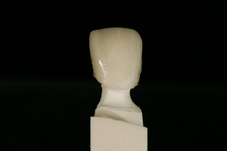 Fig. 11a