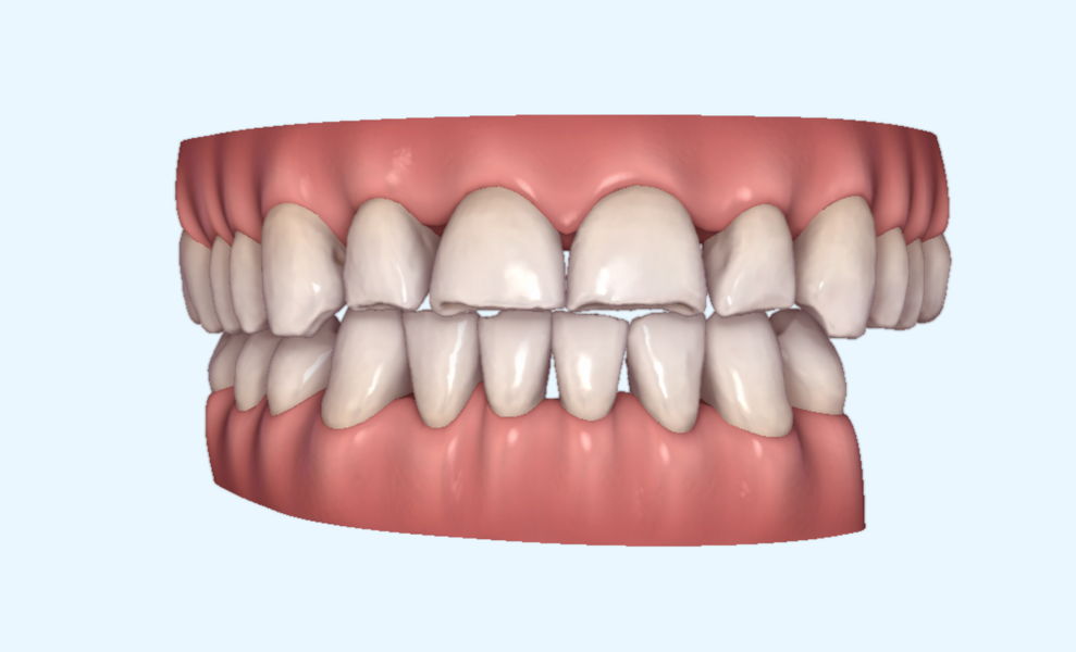 Fig. 18b