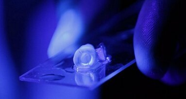 Rivoluzione nel trattamento del canale radicolare grazie ad una nuova ricerca