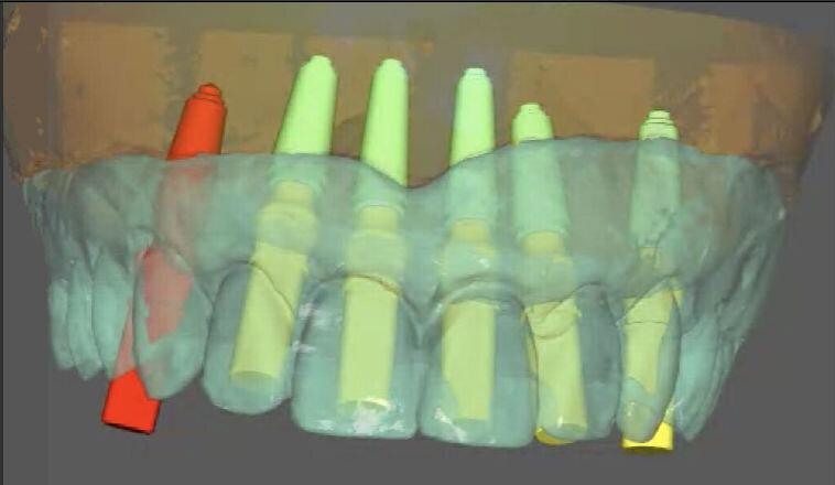Fig. 4a