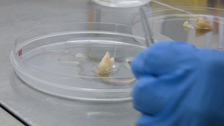 Des chercheurs étudient la possibilité de repousse de dents