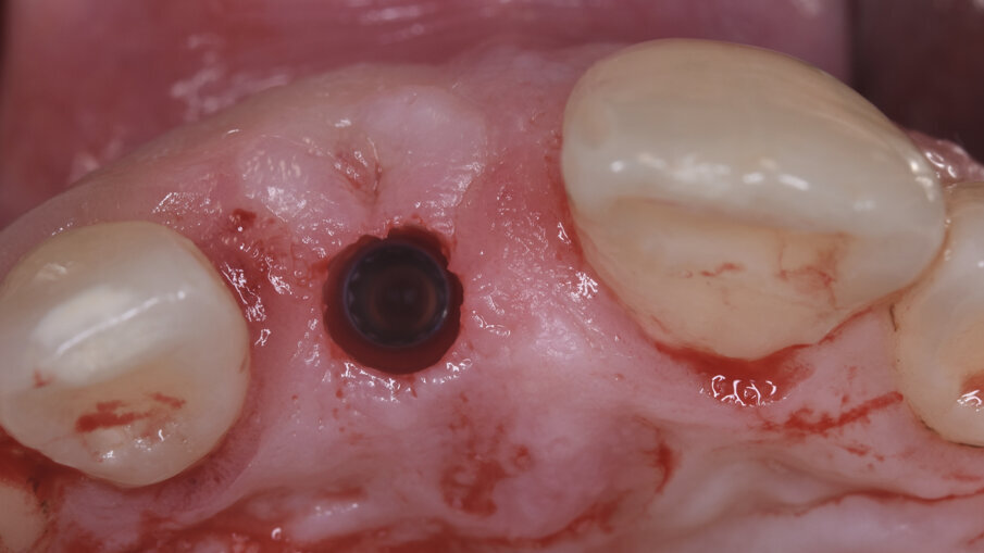 Fig. 9
