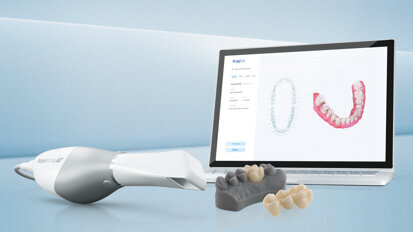 Ceramill DRS: Rozwiązania cyfrowe wkraczają do gabinetu dentystycznego