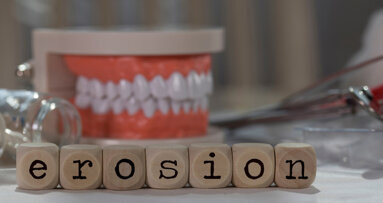 Study examines knowledge and experience of erosive tooth wear among Danish dentists