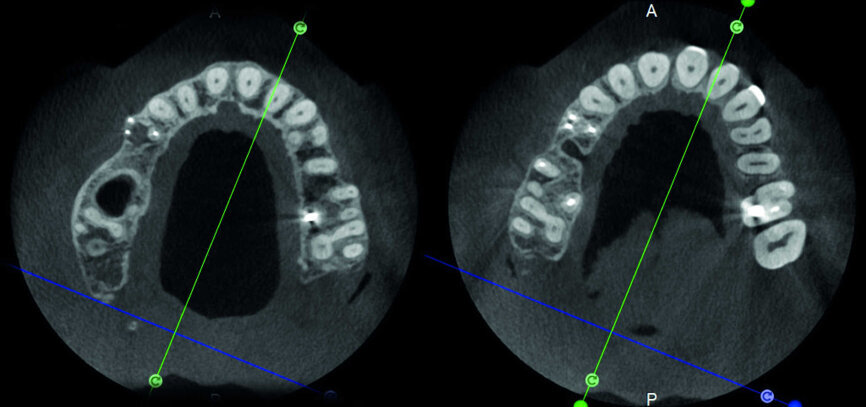Figure 25
