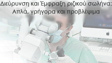 “Διεύρυνση και 'Εμφραξη Ριζικού Σωλήνα: Απλά, Γρήγορα και Προβλέψιμα”