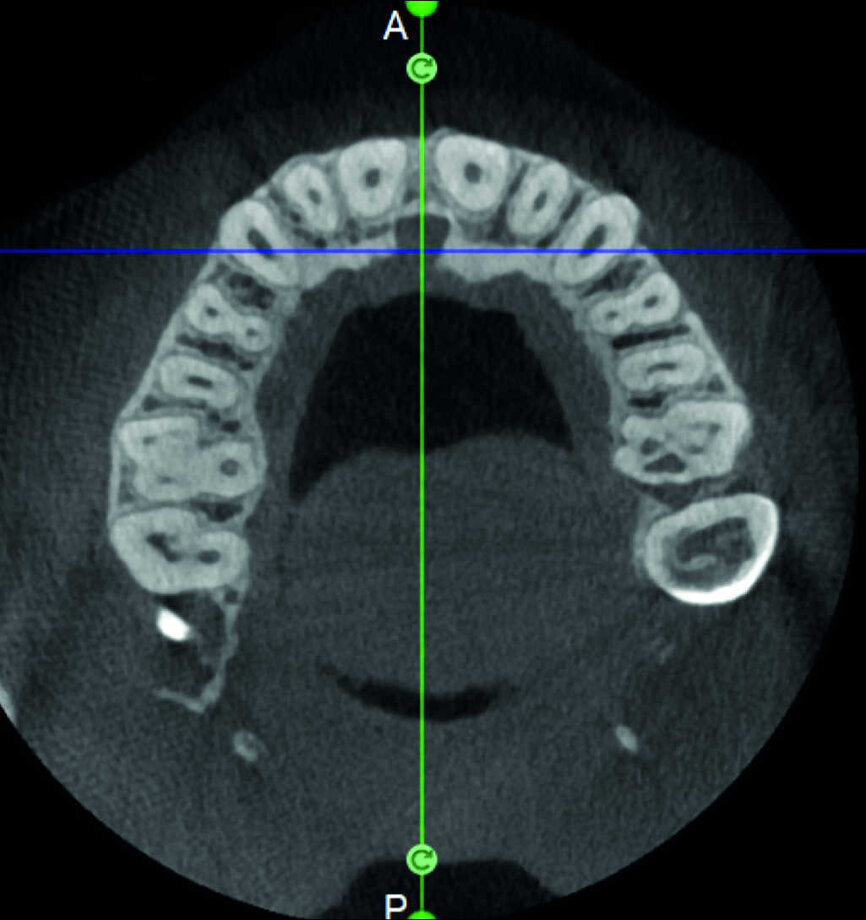 Figure 12