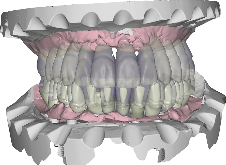 Fig. 21