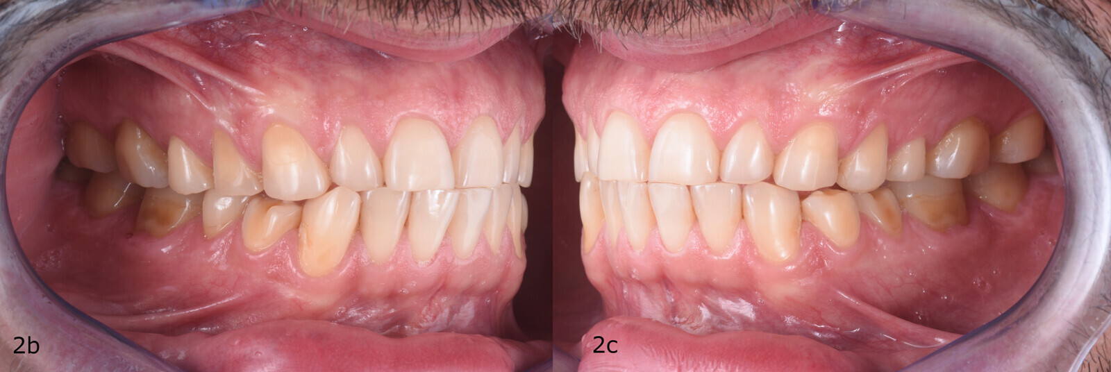 Fig. 2b-c.