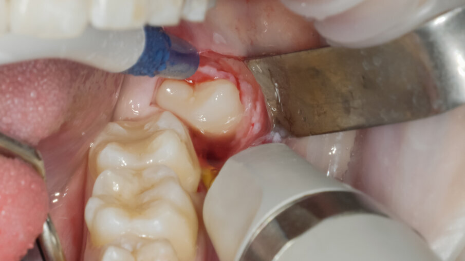 Fig. 7