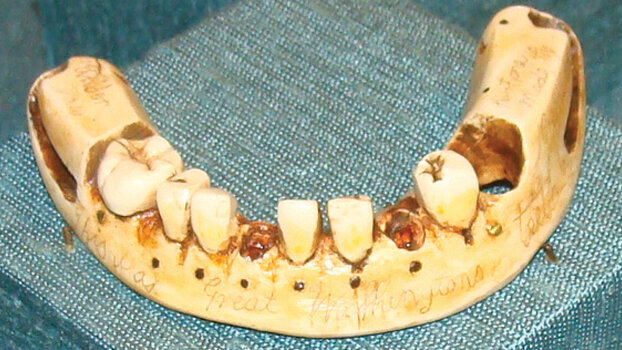 Museum dispels myth about George Washington’s teeth