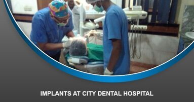Implants at City Dental Hospital