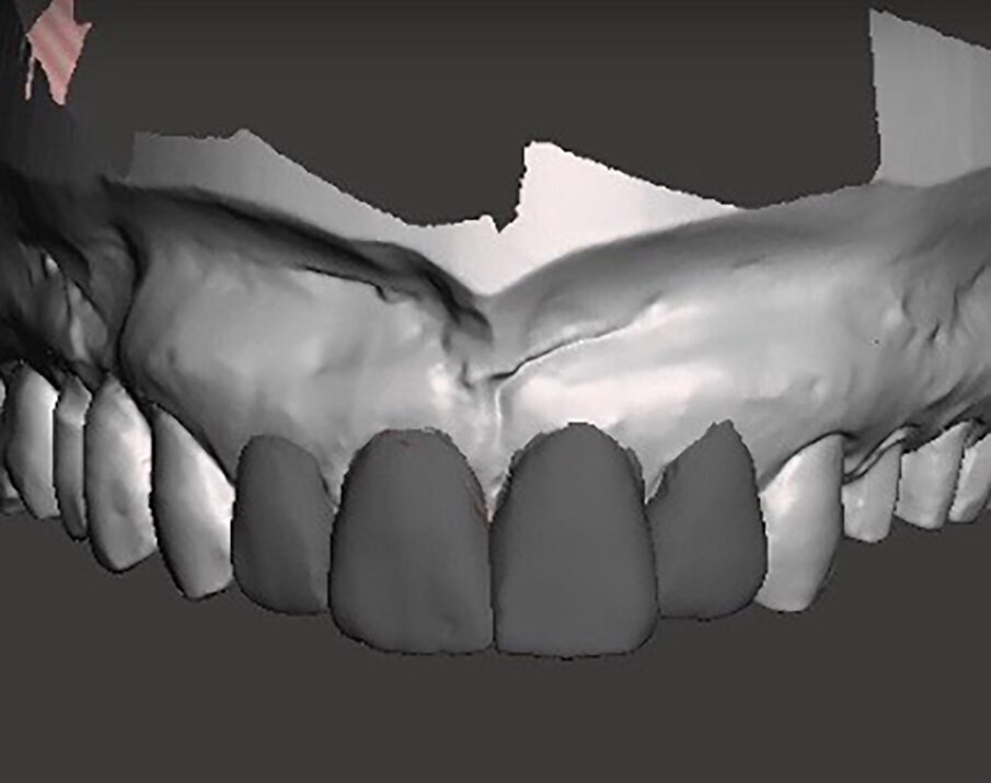Fig. 8e