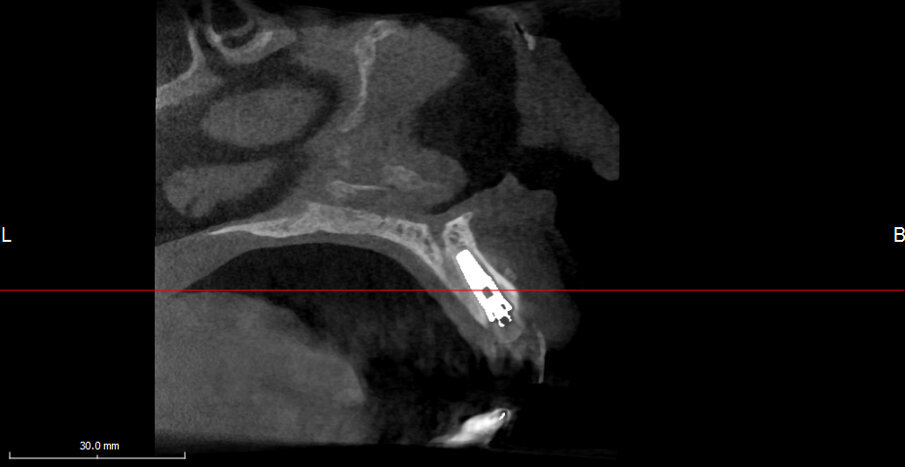 Fig. 22