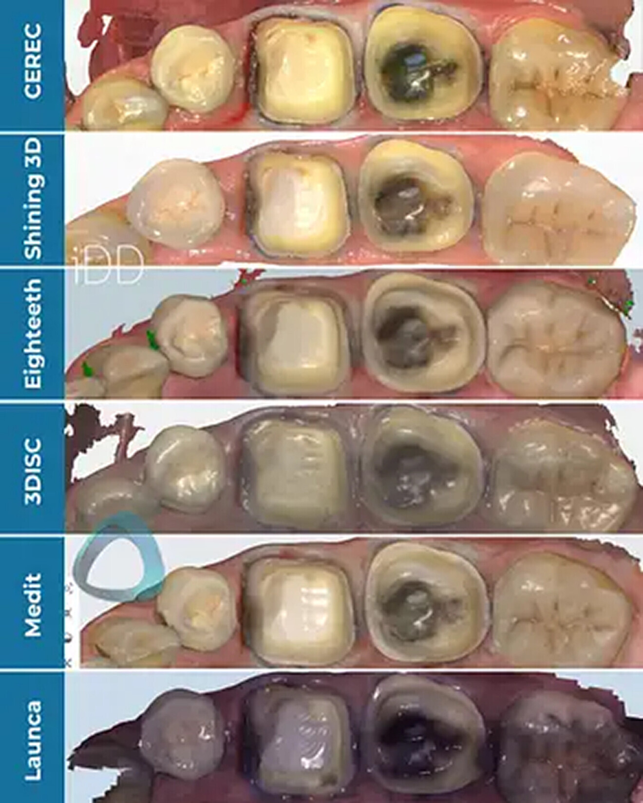 Fig. 7–9: The same preparations were scanned on the same day with six different scanners.