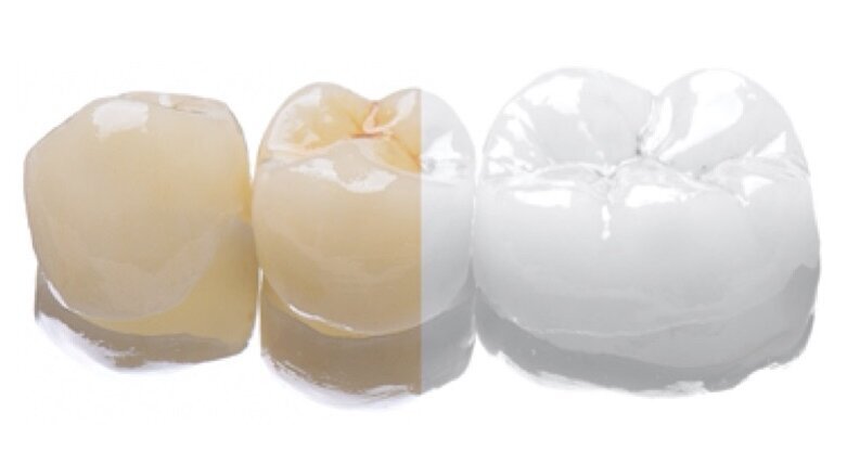 RAW vs JPEG en fotografía dental