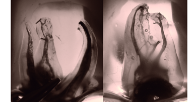 Twisted files and adaptive motion technology: A winning combination for safe and predictable root canal shaping
