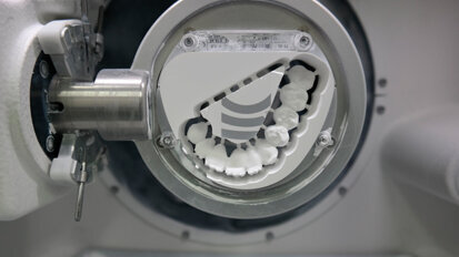 Elevate estetica e funzione con lo zirconio integrale altamente traslucente Ceramill Zolid