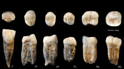 Previously lost fossilised human teeth produce new data