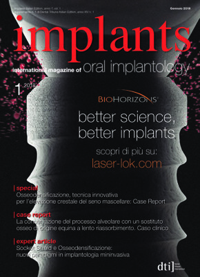 implants Italy No. 1, 2018