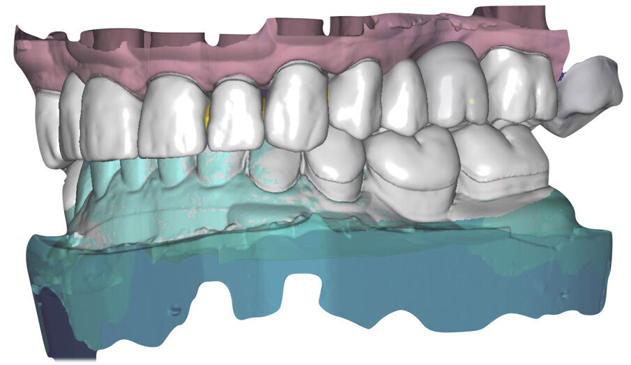 Fig. 33