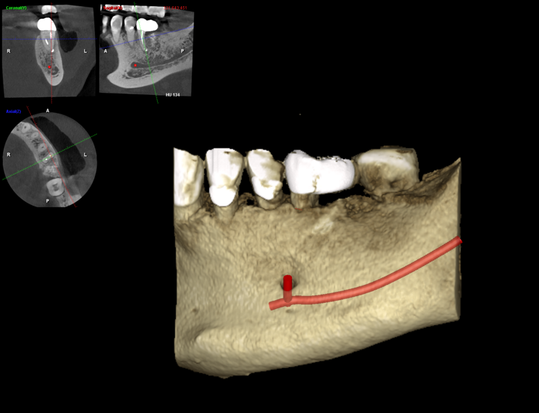 Fig. 13