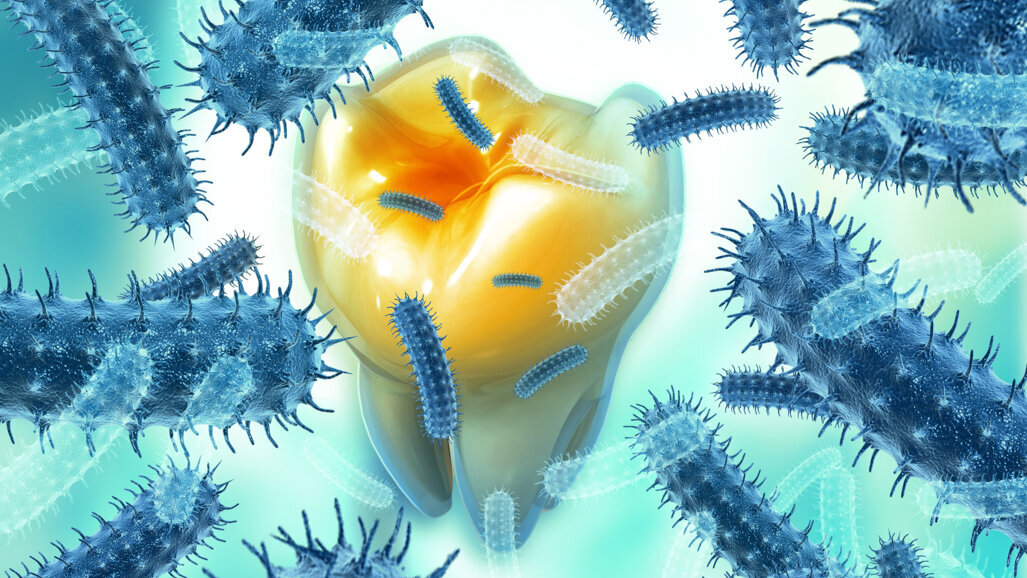 Study offers new insight into diversity and prevalence of bacteria in oral infections