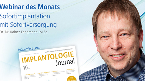 Webinar: Sofortimplantation mit Sofortversorgung
