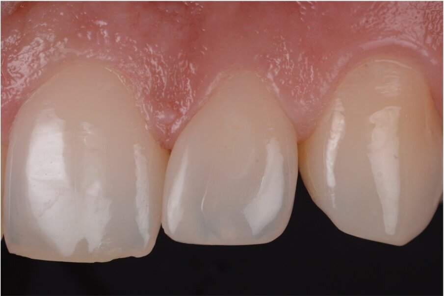 Case 1, Fig. 3.