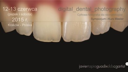 Fotografia i planowanie uśmiechu – kurs dla lekarzy dentystów