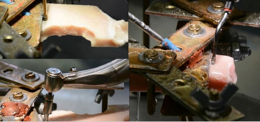 Fig. 4 - Valutazioni fisiche ex vivo su osso di calvaria suina. Mediante una termocoppia vengono rilevate le variazioni di temperatura durante l’esecuzione di osteotomie per la preparazione dei tunnel implantari. In alto a sinistra la sistematica piezoelettrica, in basso le frese con stop di profondità, a destra gli inserti sonici per la preparazione del sito implantare.