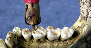 Historia de la odontología. Capítulo I: Primeras técnicas odontológicas
