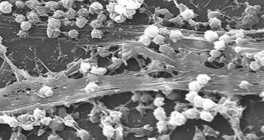 Beschermende coating vermindert aanhechting bacteriën