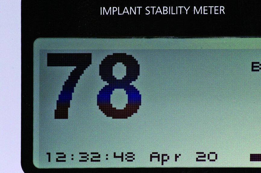 Fig. 13: Capturing an ISQ reading with Osstell.