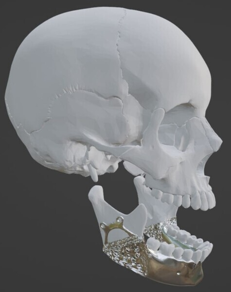 Fig 1d