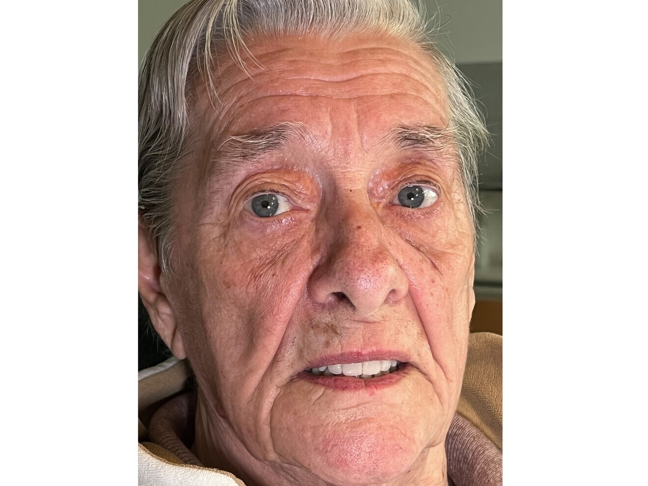 Fig. 11: Denture in situ.