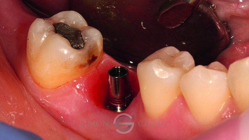 Fig.: 7