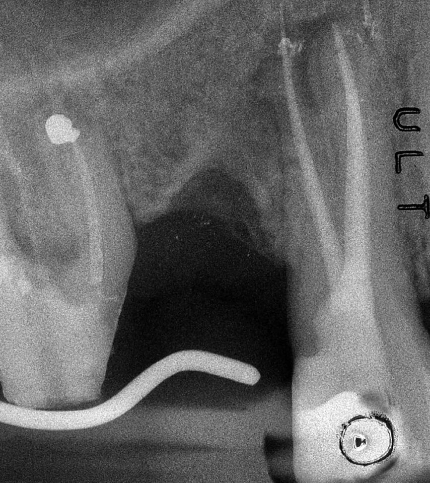 Figure 23