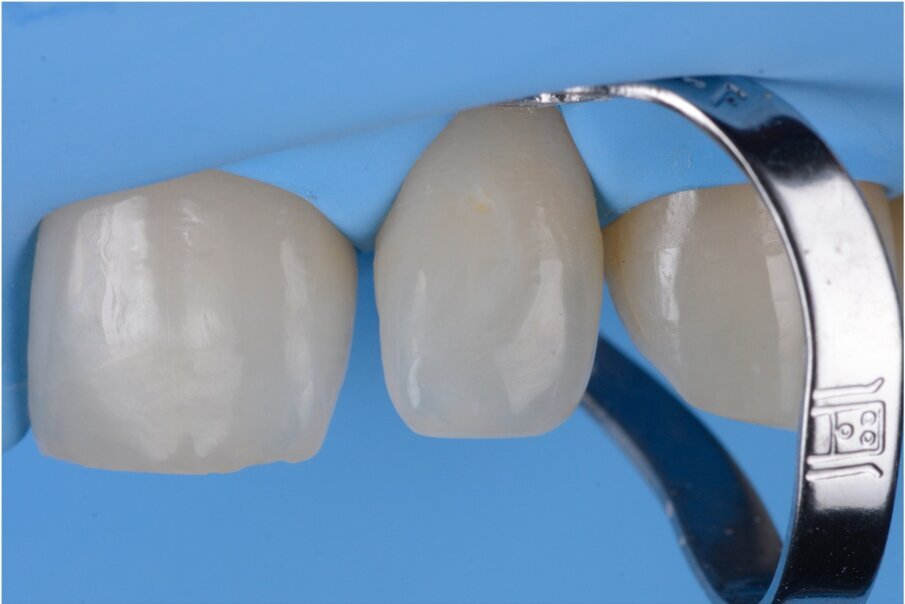Case 1, Fig. 2.