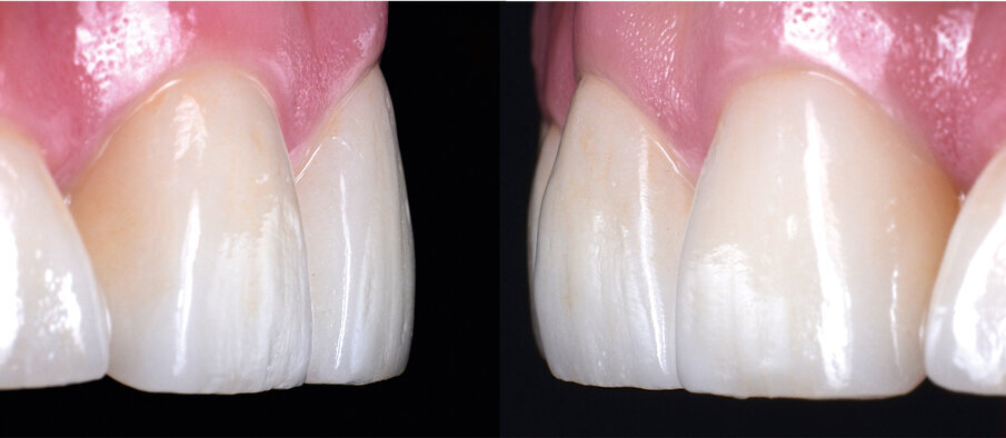 Fig. 14-15: Result after one month in situ