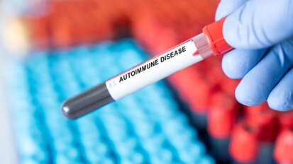 Study links periodontal disease to autoimmune disease and all-cause mortality