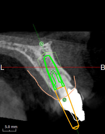 Fig. 11b