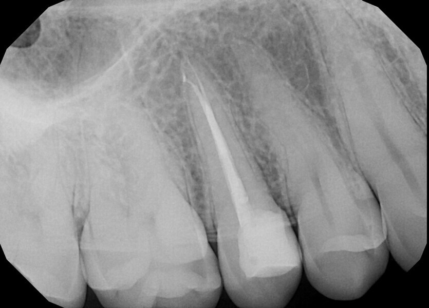 Fig. 21d.