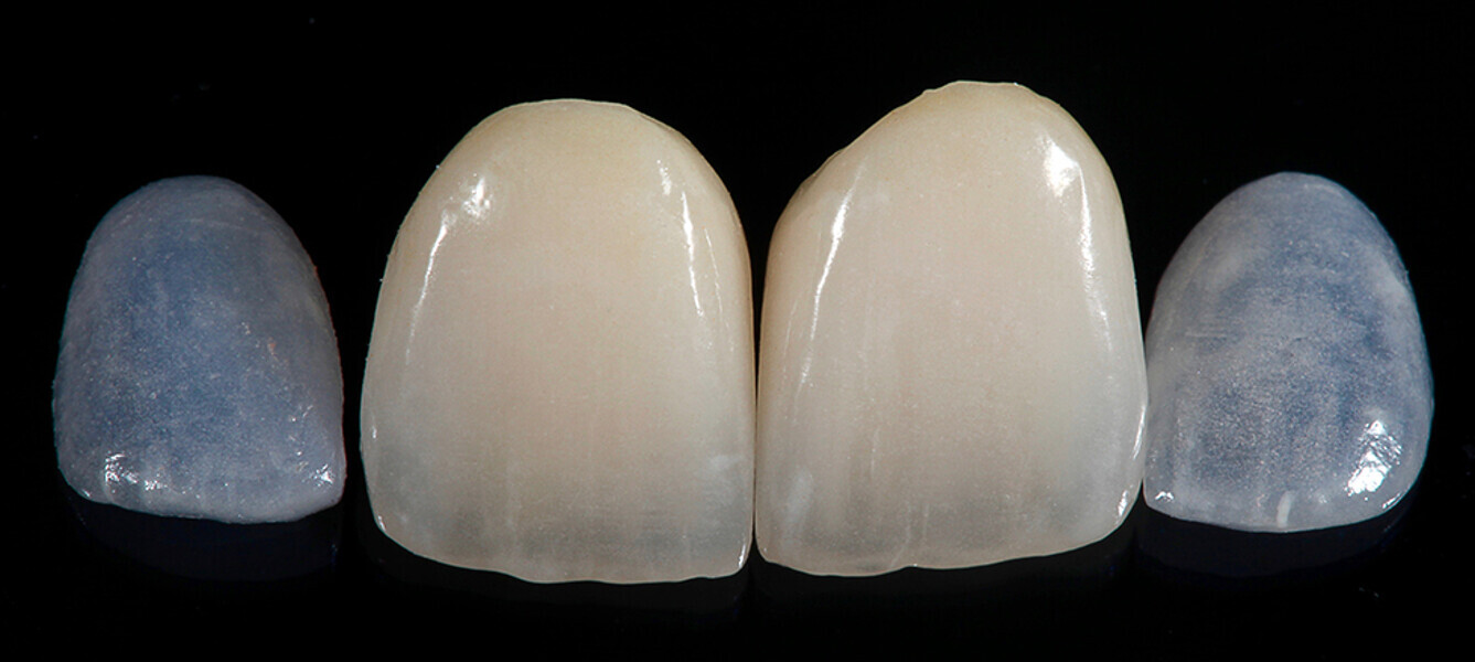 Fig. 12