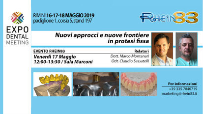 Riabilitazioni fisse full-arch: presentazione della sistematica OT Bridge