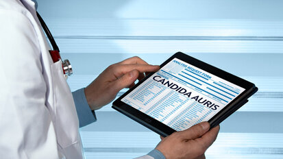 Centers for Disease Control and Prevention release statement on spread of Candida auris