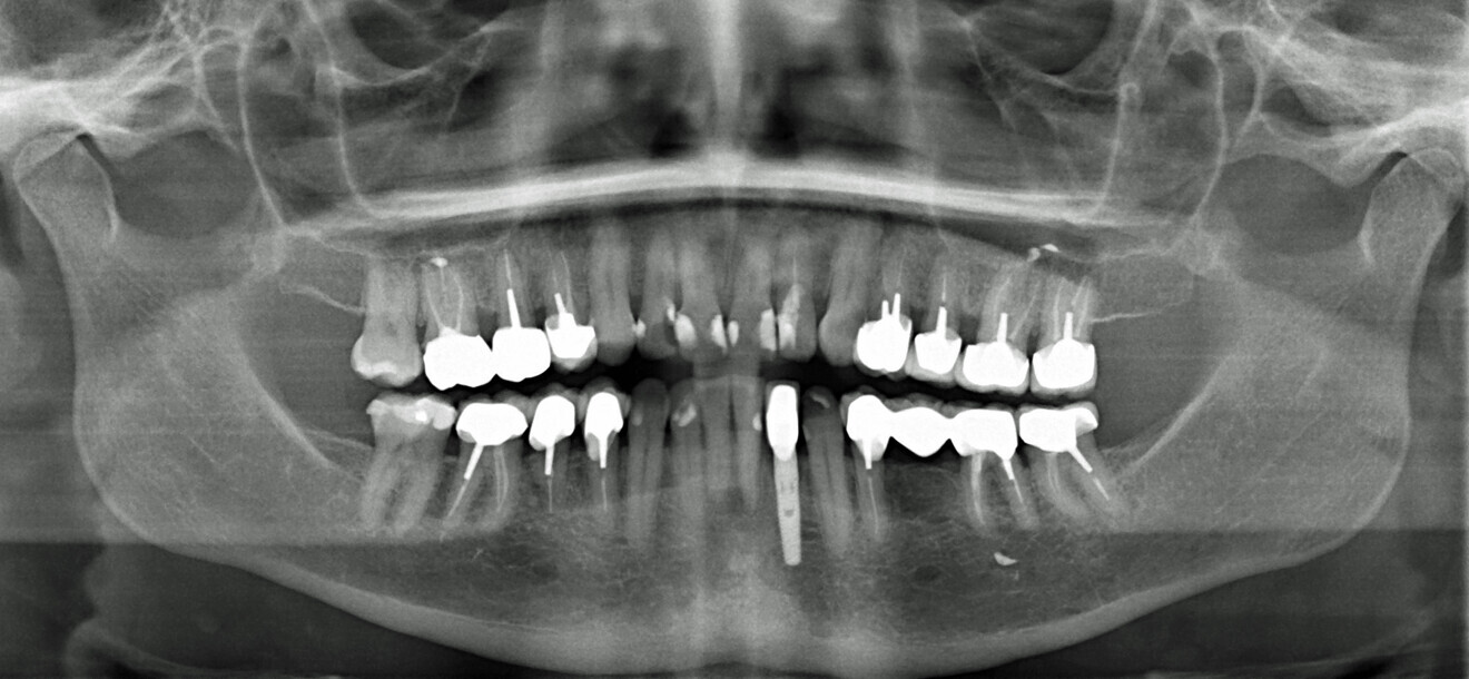 Fig. 2: Radiographie initiale. 