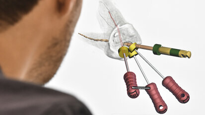 IDS to showcase wealth of possibilities offered by digital endodontics
