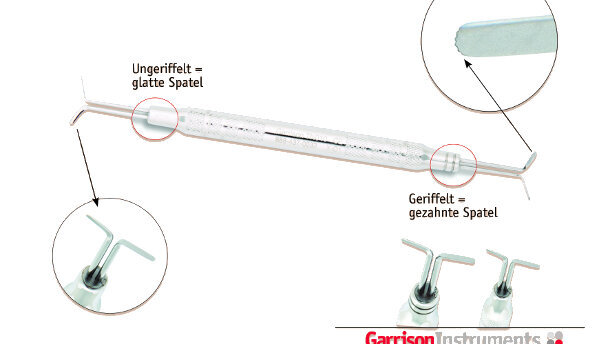 Leichteres Legen von Retraktionsfäden mit einzigartigem Instrument