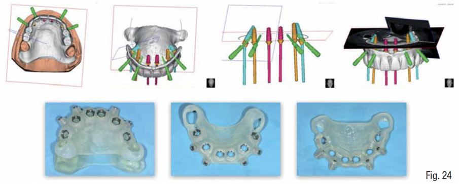 Fig. 24